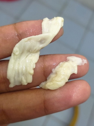 Keputihan. Kalau geli jangan tengok gambar