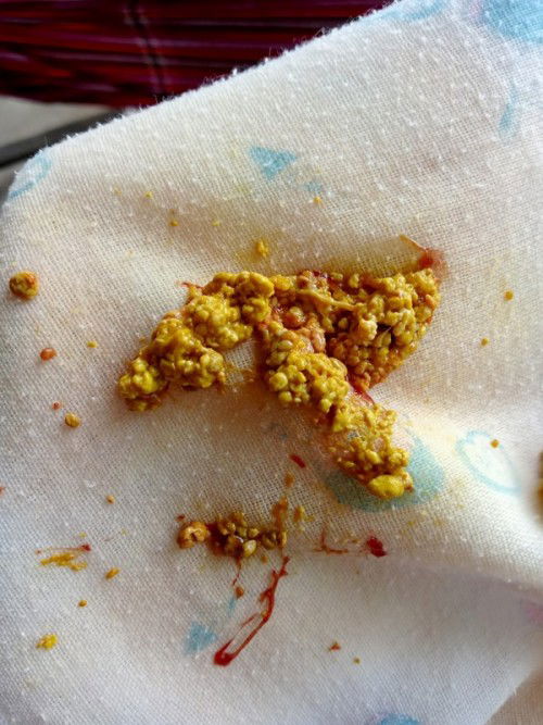 แม่ๆขอสอบถามหน่อยนะค่ะ