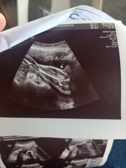 Gender. Girl or Boy?