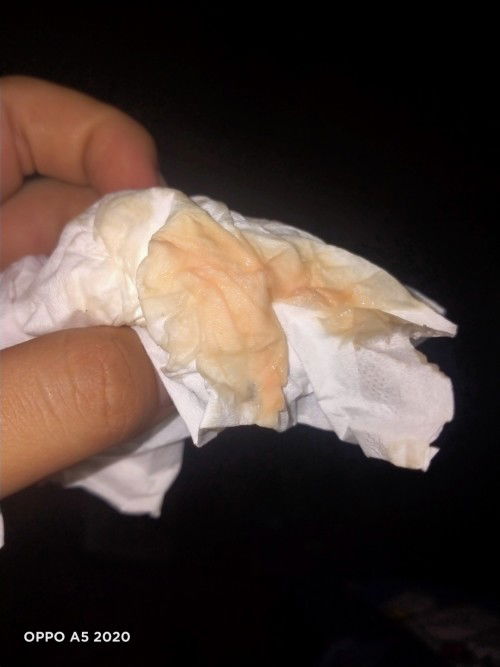 ขอถามแม่ๆหน่อยตอนนี้ได้37วีด3วัน  มีแม่บ้านใหนเคยเป็นตกขาวปนเลือดบ้าง เป็นอันตรายไหมไปหาหมอก็ไล่กลับ