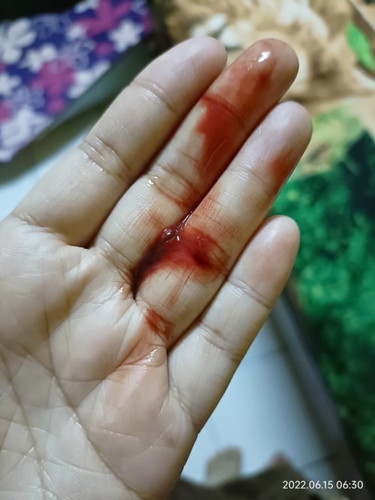 Trimester pertama