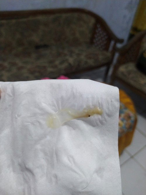 Ada yang pernah ngalamin kyak gini gak ya? Usia kehamilan 7week