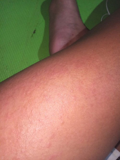 ANONG GAMOT SA GANITONG PANGANGATI NG BAGONG PANGANAK?