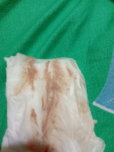 Keputihan coklat