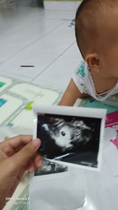 Apa efek samping hamil muda masih mengASI hi.