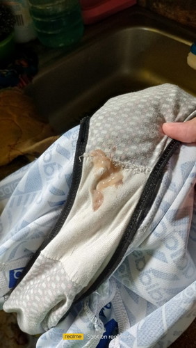 37weeks 2days na po ako now 1cm