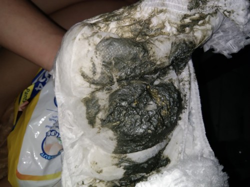Assalamualaikum Bu ibu mau nanya maaf ni anak saya pake susu Morinaga BMT 0-6 tapi ko begini