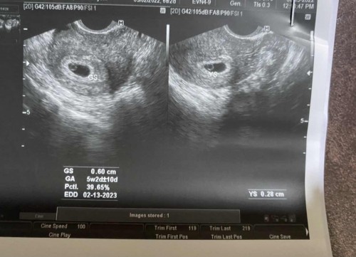 SPOTTING @ 6wks3days