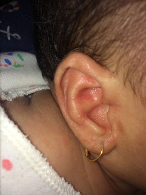 Bunda ada yang baby nya pernah gini gak ya? Sharing yuk bun.