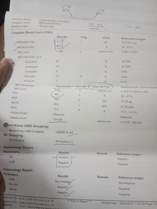 น้องมีความเสี่ยงดาวซินโดรมไหมคะ