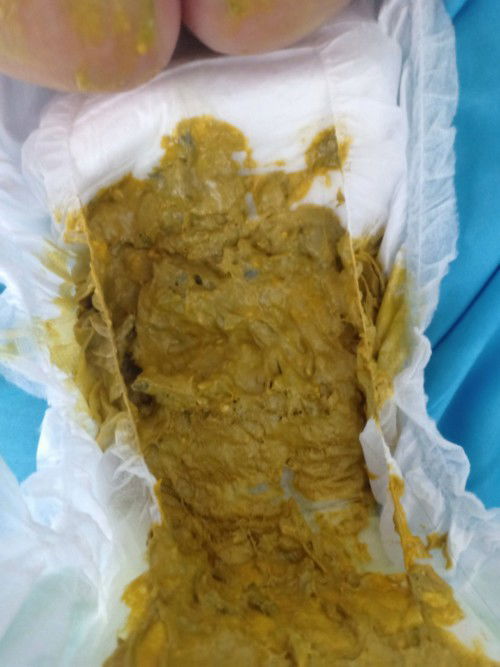 Apakah warna pup seperti ini normal?