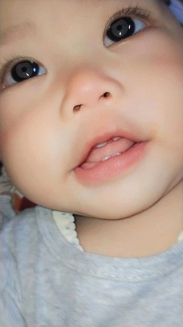 anak belum bisa merangkak