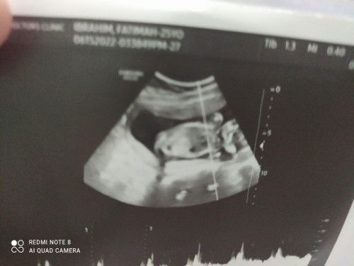 May gnito ba dto  ang resulta