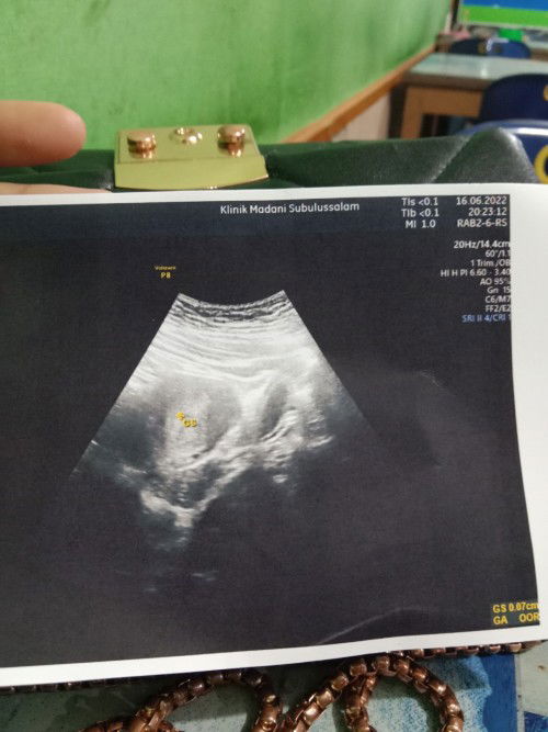 Mau nanyak bun saya USG tadi