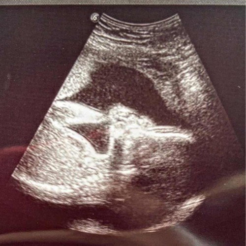 22 weeks & 4 days