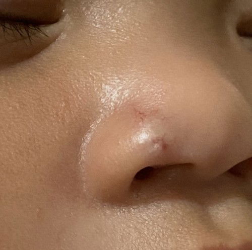 Lumalaking parang ugat