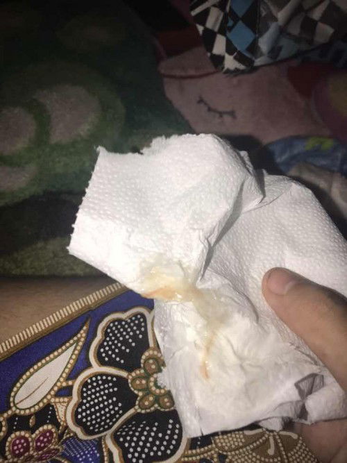 มีมูกเลือดคือสัญญานการใกล้คลอดไหมคะ