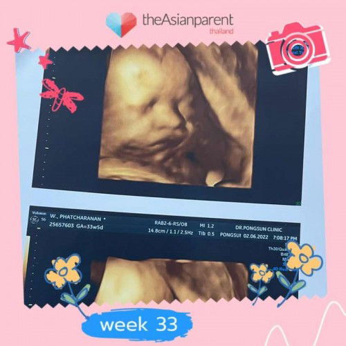 ทีม กค ค่ะ จะอยู่ถึงไหมน้อ😅