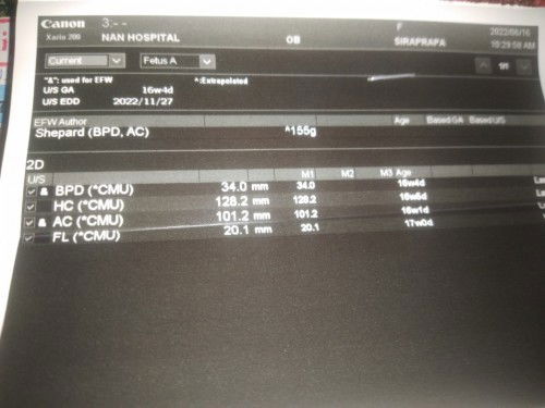 ลูกชายล้วน