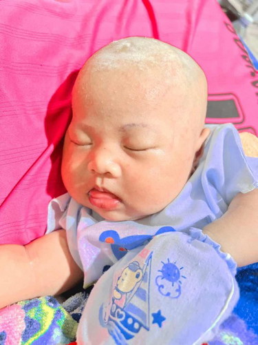 สอบถามเพื่อลูกน้อย