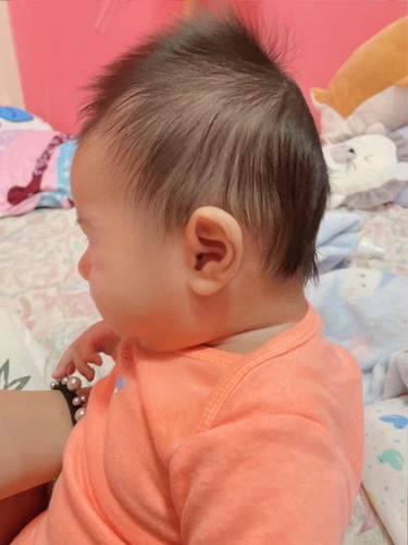 ลูกหัวแบนมาก แม่แอบนอยกลัวลูกหัวไม่สวย