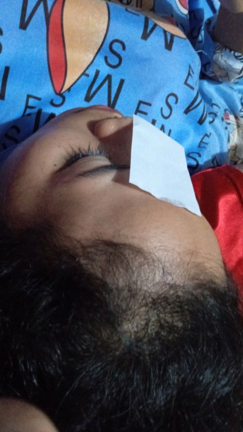 Sering mengalami sakit pinggang