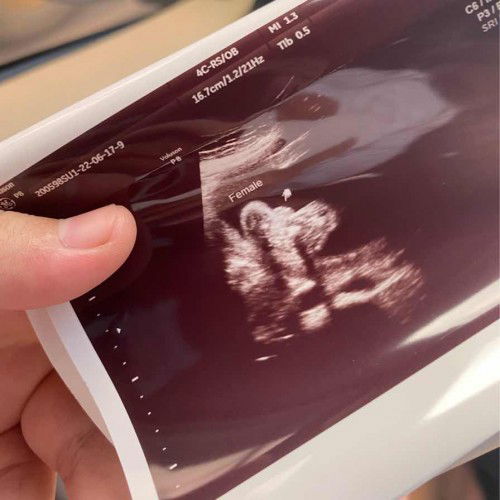 เพศชายหรือเพศหญิง