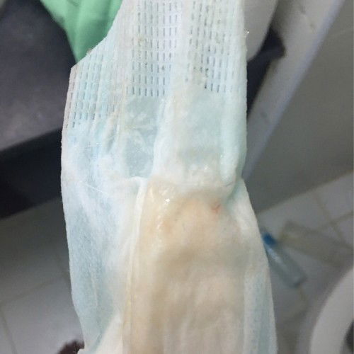 ตั้งครรภ์ได้36+3 มีมูลออกแบบนี้ ใกล้คลอดหรือยังค่ะ#ท้องแรก