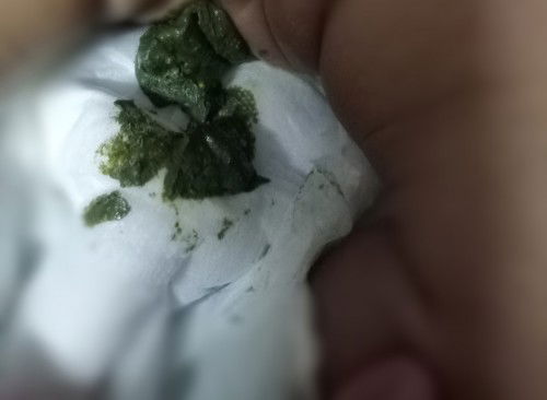 nak tanya kenapa najis baby sy warna mcm ni ye..? baby minum susu simillac total comfort step 1