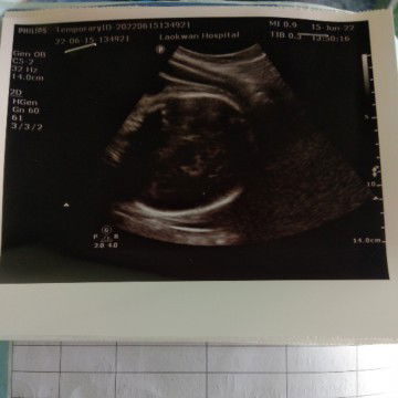 36w แม่ๆพอจะดูออกไหมคะ