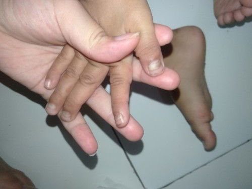 Kuku tangan dan kaki anak