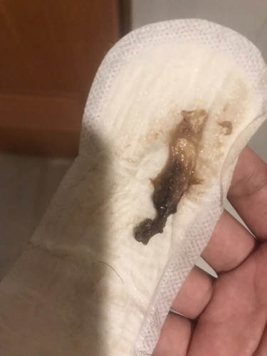 Mucus Plug