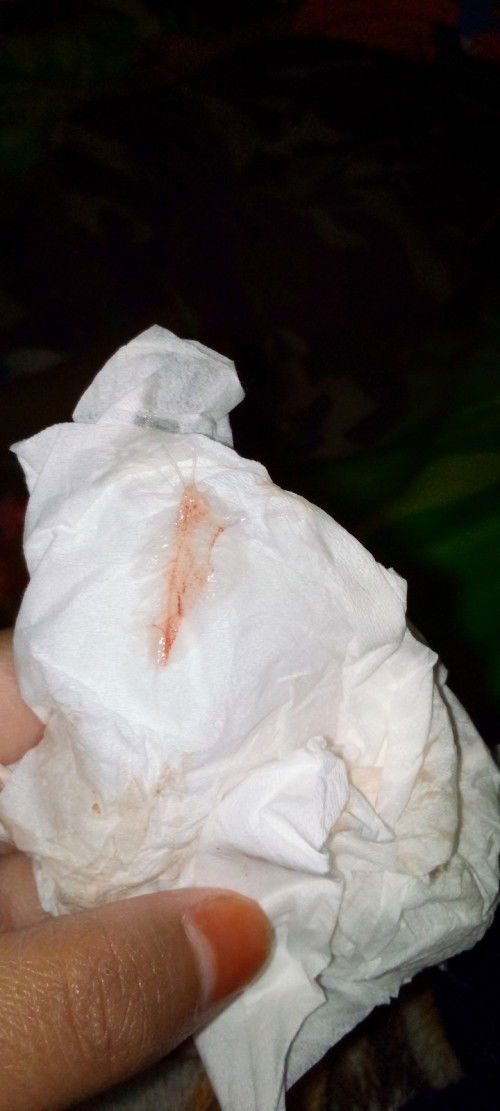 Flek setelah berhubungan