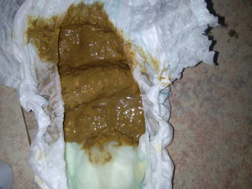 NIDO POOP NORMAL BA?