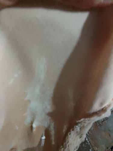 ท้อง7เดือนท้องแฝด