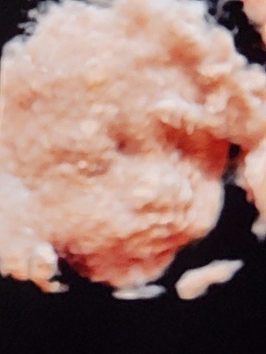 Scan hari ni, alhamdulillah baby sihat. Moga dalam lindunganya.