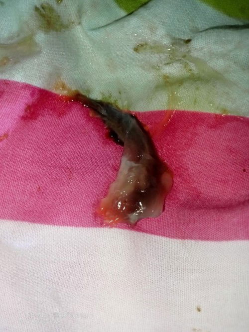 ขอถามแม่ๆที่มีประสบการณ์ในการคลอดธรรมชาติหน่อยค่ะ