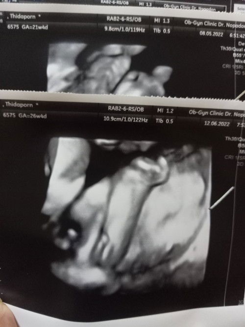 ตอน26วิคชายหรือหญิงน่ะ