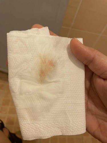 ท้อง4สัปดาห์แล้วมีเลือดไหล กังวลมากค่ะ เคยแท้งไปท้องแรกตอน 7สัปดาห์