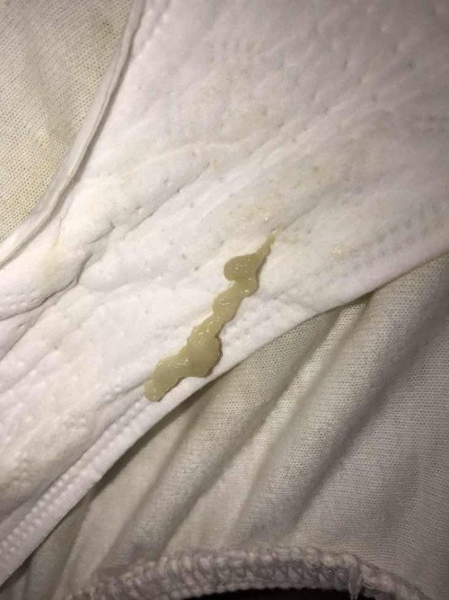Mucus plug discharge na po ba ito? Ano po ibig sabihin nyan 39w pregnant po ako..