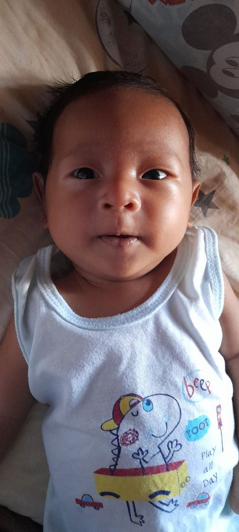 Tanong ko lang po bakit po kaya namumuti yung gilid ng mata ng baby ko sa right side po niya