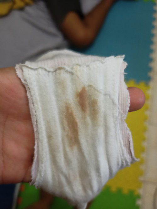 May kaunting spotting