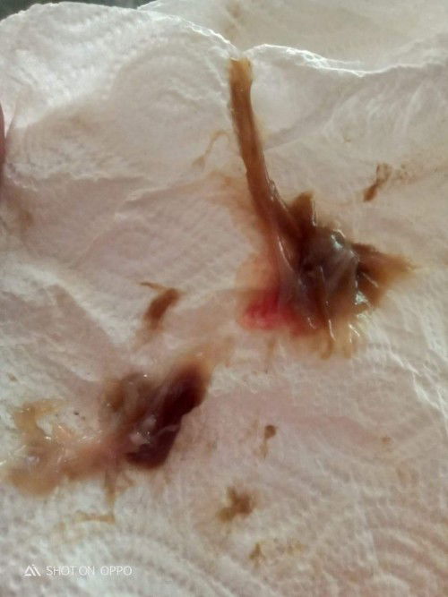 แบบนี้ควรทำยังไง