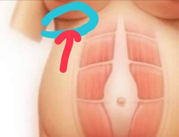 มีใครเคยปวดตรงที่ทำลูกศรไว้ป่าวค่ะ
บางคนว่า ครรภ์เป็นพิษจริงป่าวค่ะ
