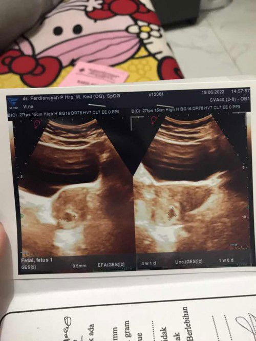 Bun mau tanya saya bingung