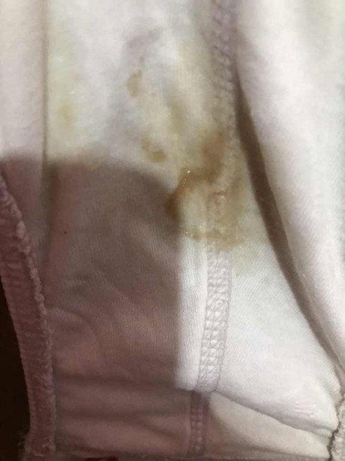 Mucus plug na po ba yan?