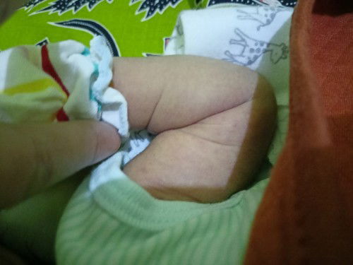 Newborn bintik-bintik merah di lengan