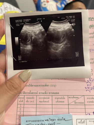 ฝากครรภ์ 6w