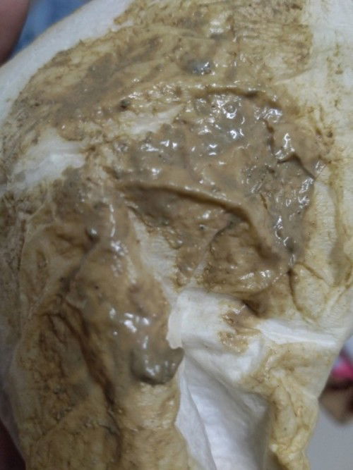 ขออนุญาติค่ะ เรื่องการถ่ายของลูก 1 ขวบ2เดือน