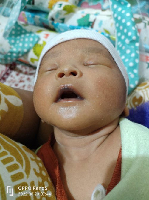 Bibir bayi usia 11 hari kenapa hitam ya?